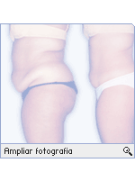 -- Ampliar fotograf&iacute;a --