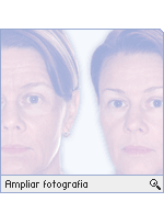 -- Ampliar Fotografia --