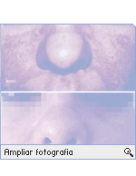 -- Ampliar Fotografia --