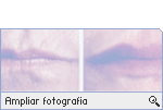 -- Ampliar Fotografia --