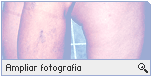 -- Ampliar Fotografia --