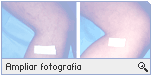 -- Ampliar Fotografia --