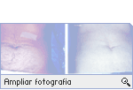 -- Ampliar Fotografia --