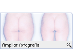 -- Ampliar Fotografia --