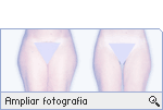 -- Ampliar Fotografia --