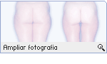 -- Ampliar Fotografia --