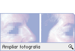-- Ampliar Fotografia --