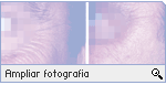 -- Ampliar Fotografia --