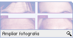 -- Ampliar Fotografia --