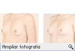 -- Ampliar Fotografia --