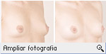 -- Ampliar Fotografia --