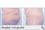 -- Ampliar Fotografia --
