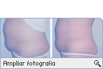-- Ampliar Fotografia --