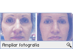 -- Ampliar Fotografia --