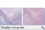 -- Ampliar Fotografia --