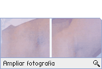 -- Ampliar Fotografia --