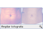 -- Ampliar Fotografia --